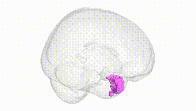 Full Brain White