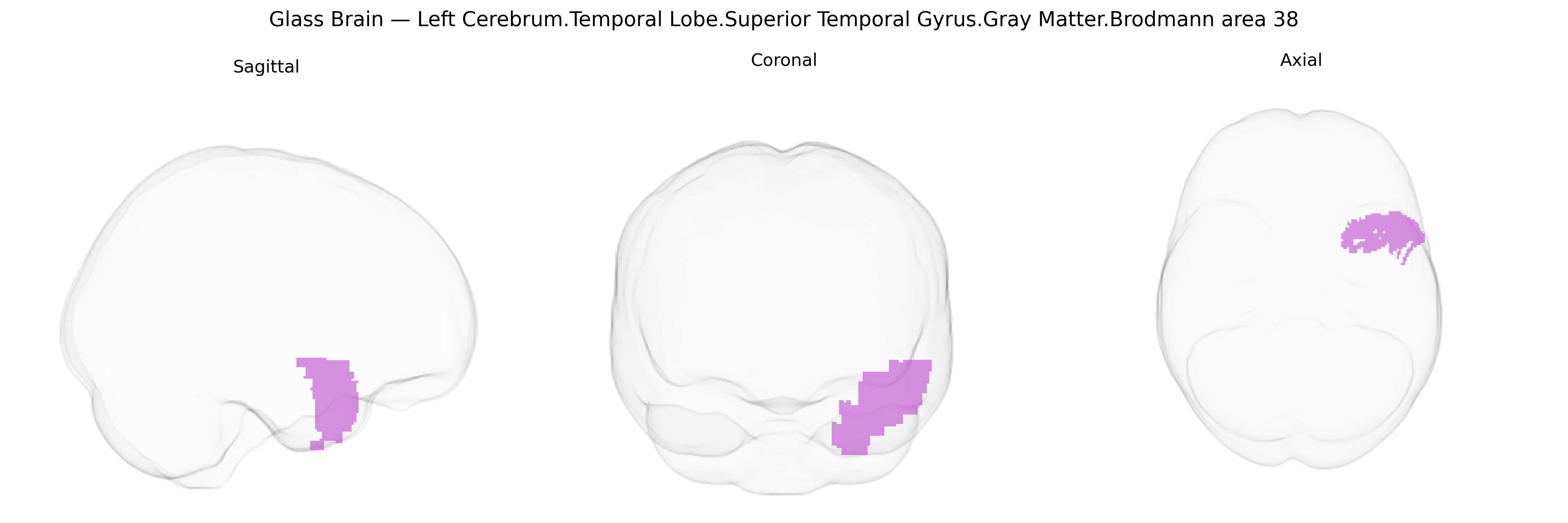 Triplanar Ghost Brain