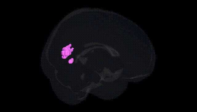 Full Brain Black