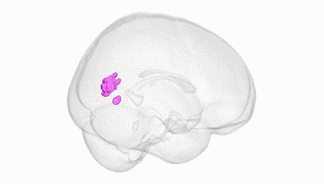 Full Brain White