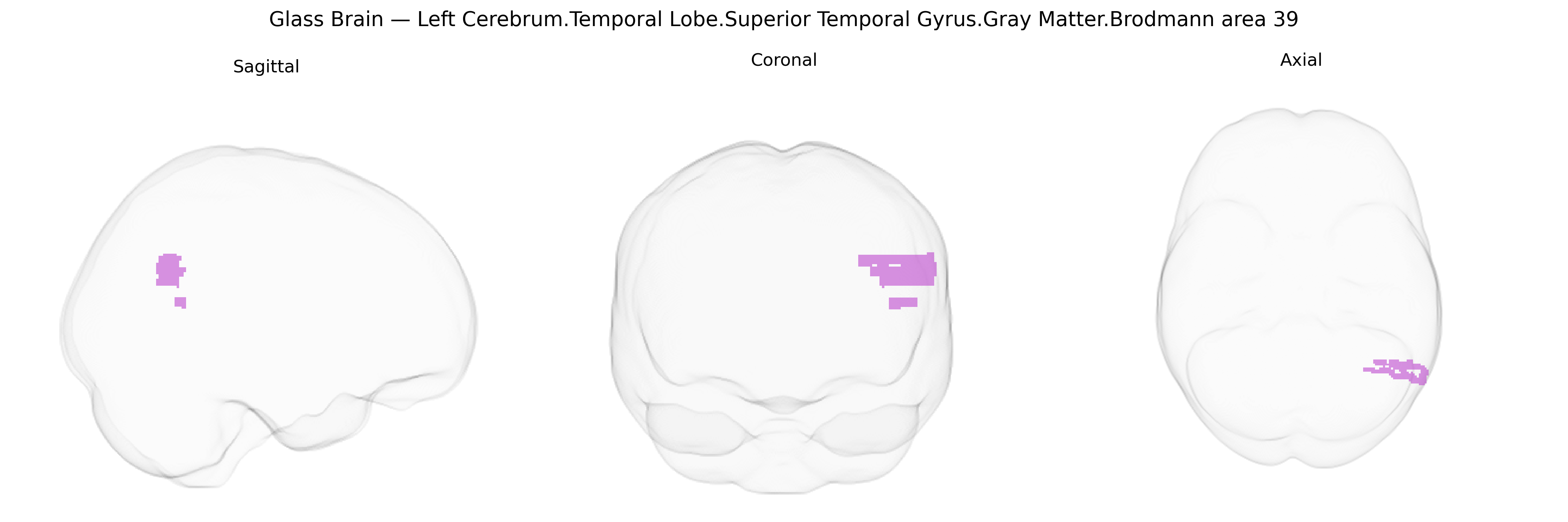 Triplanar Ghost Brain