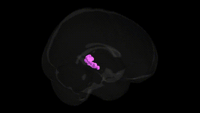 Full Brain Black