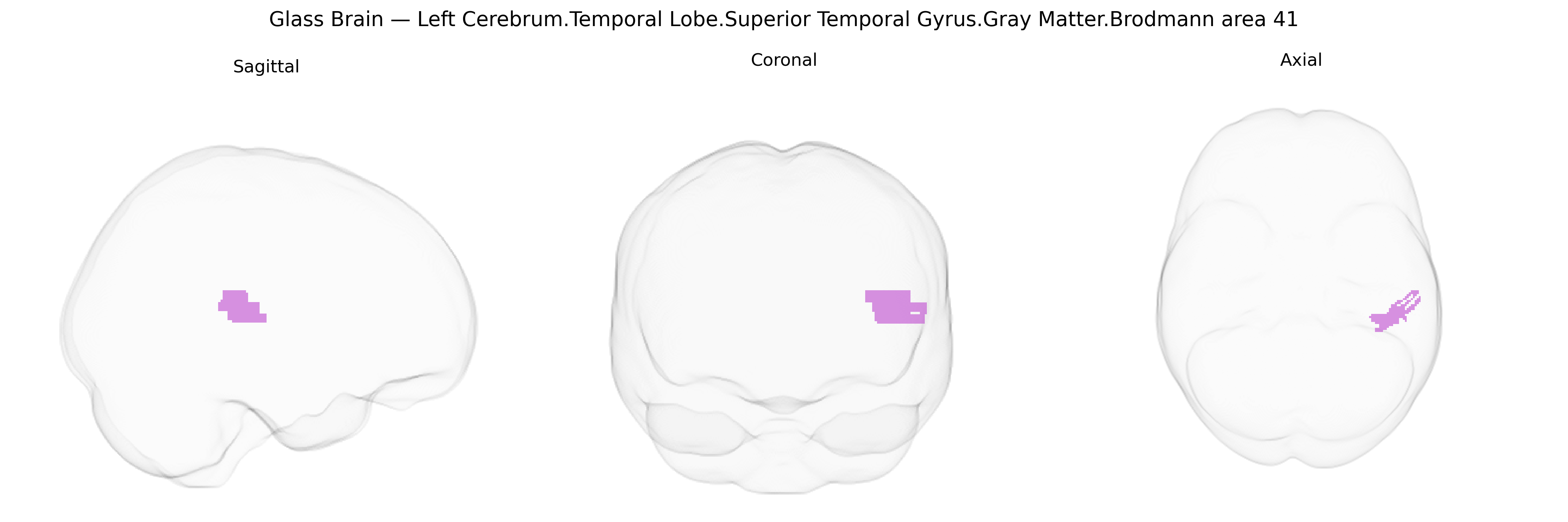 Triplanar Ghost Brain