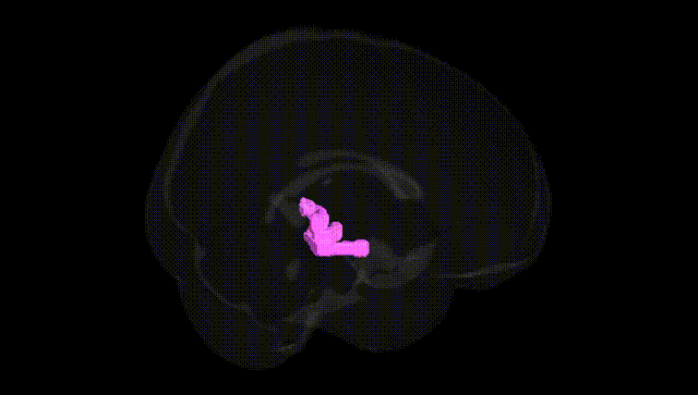 Full Brain Black