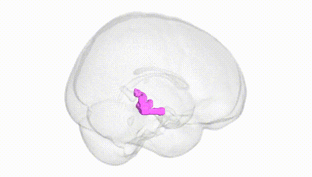 Full Brain White