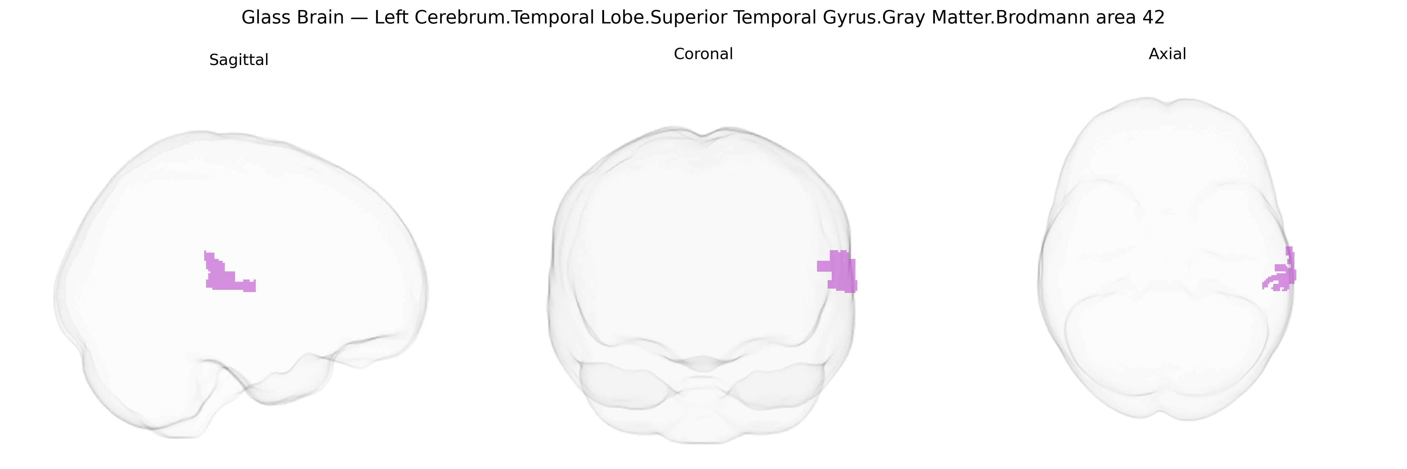 Triplanar Ghost Brain