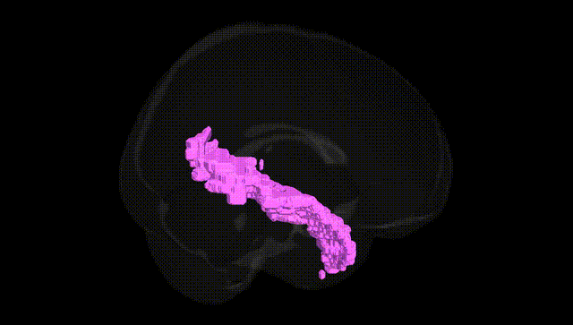 Full Brain Black