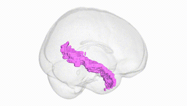 Full Brain White