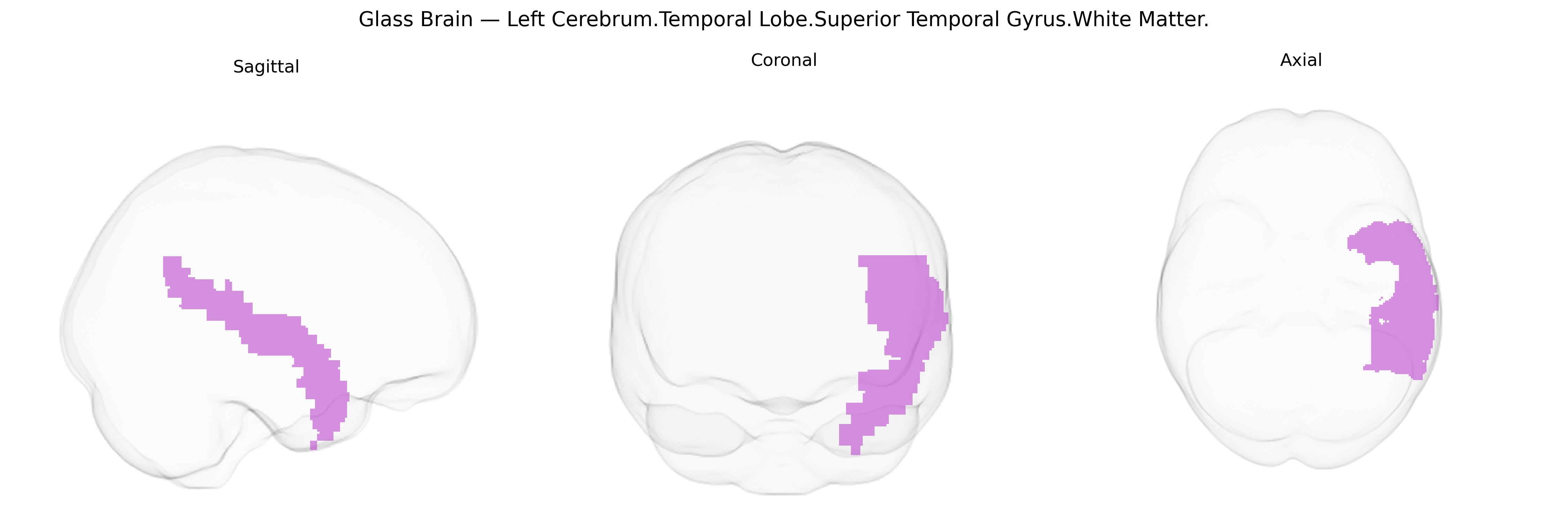 Triplanar Ghost Brain