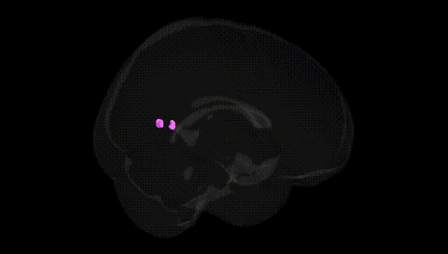 Full Brain Black