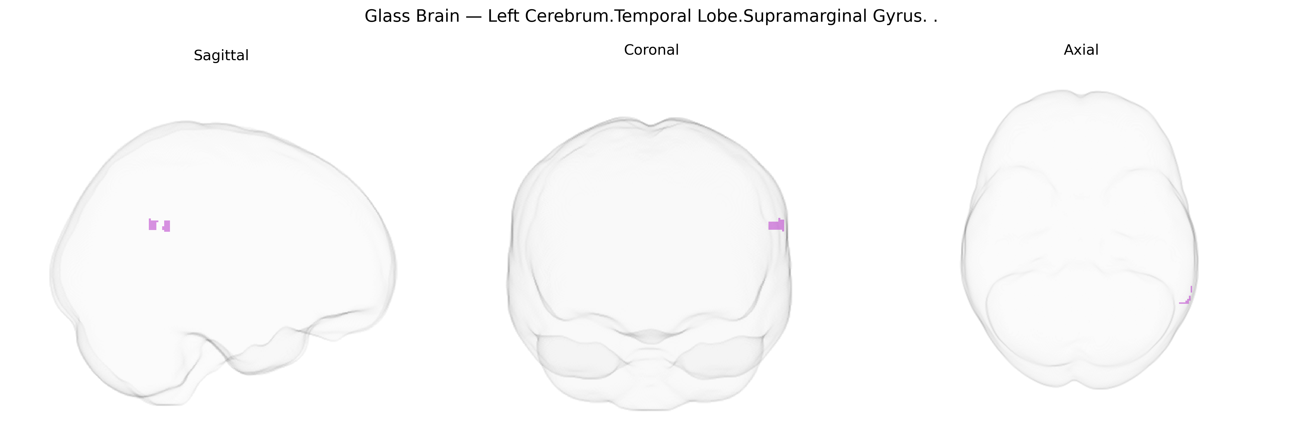 Triplanar Ghost Brain
