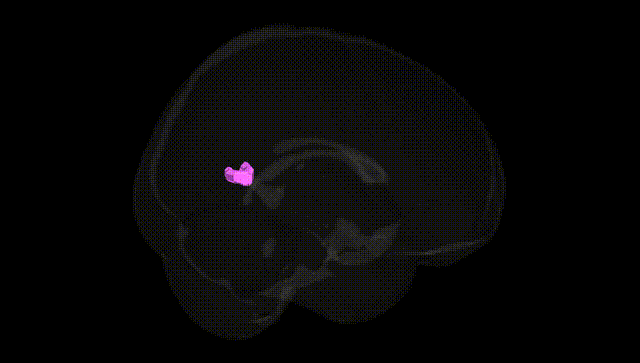 Full Brain Black