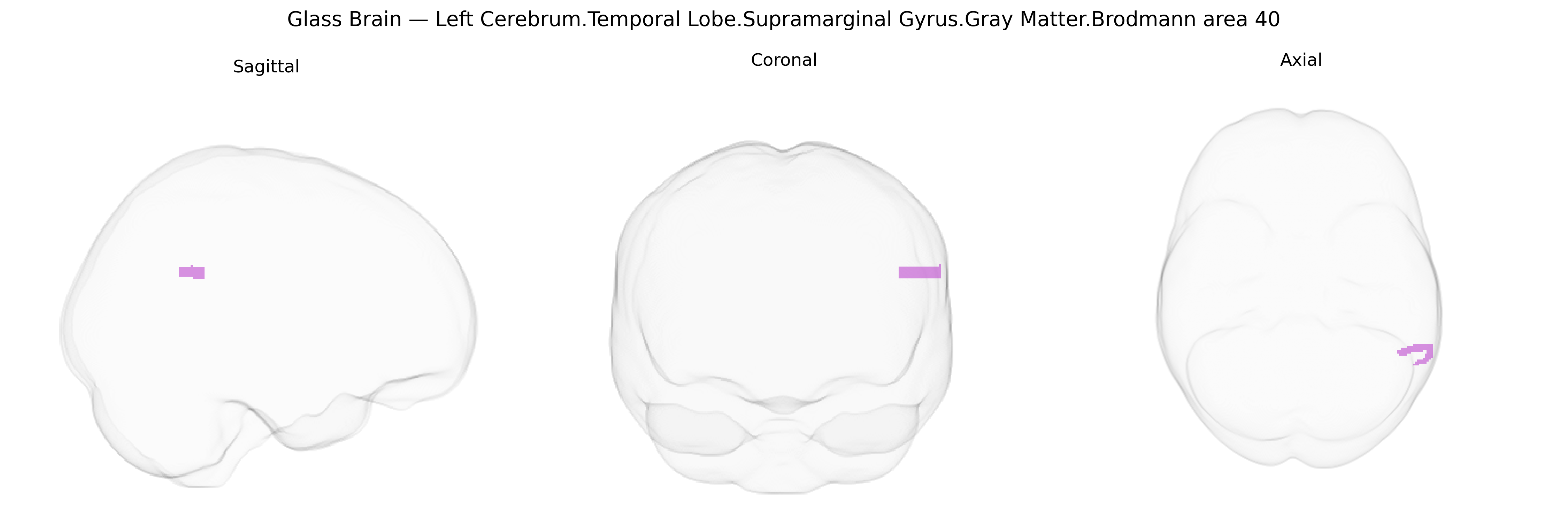 Triplanar Ghost Brain