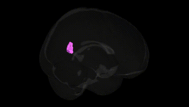 Full Brain Black