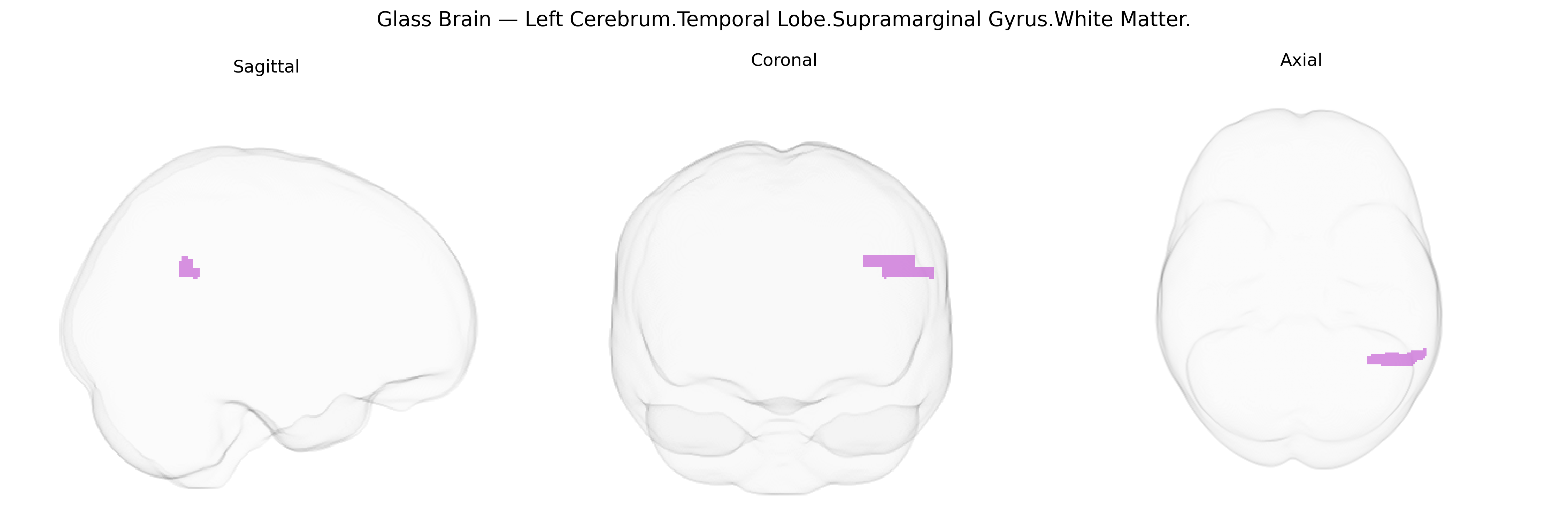 Triplanar Ghost Brain