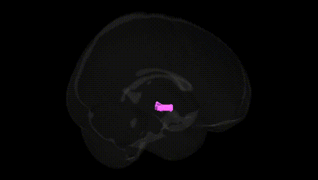Full Brain Black