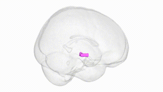 Full Brain White