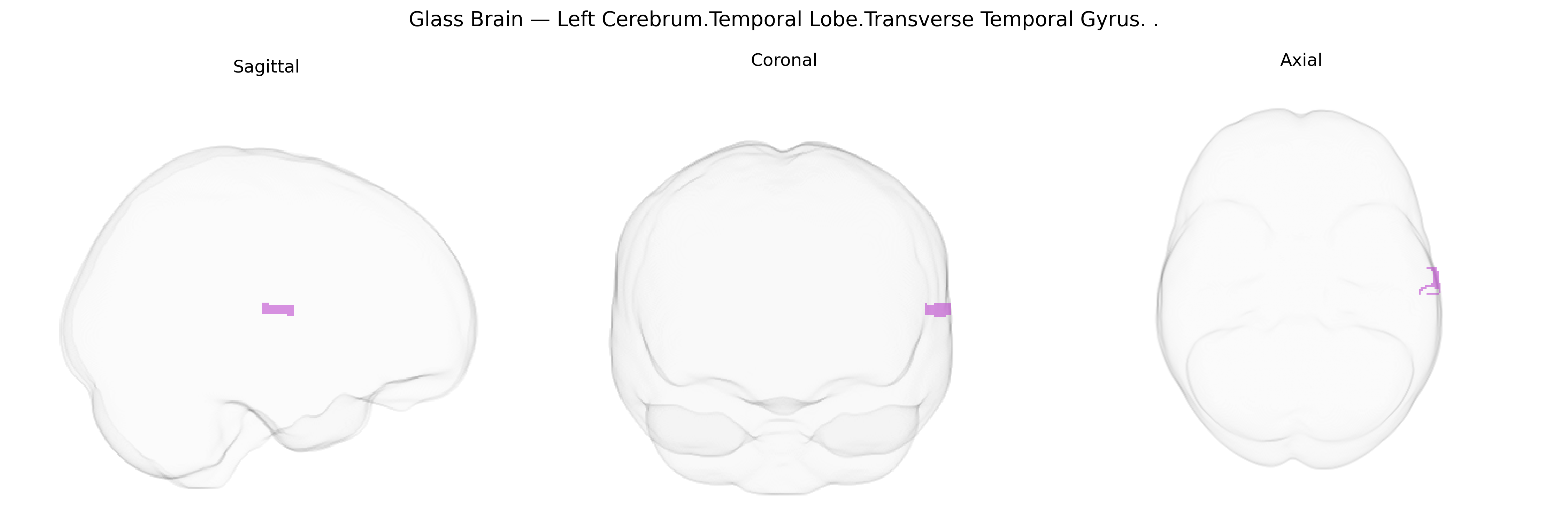 Triplanar Ghost Brain