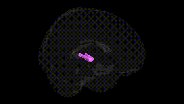 Full Brain Black