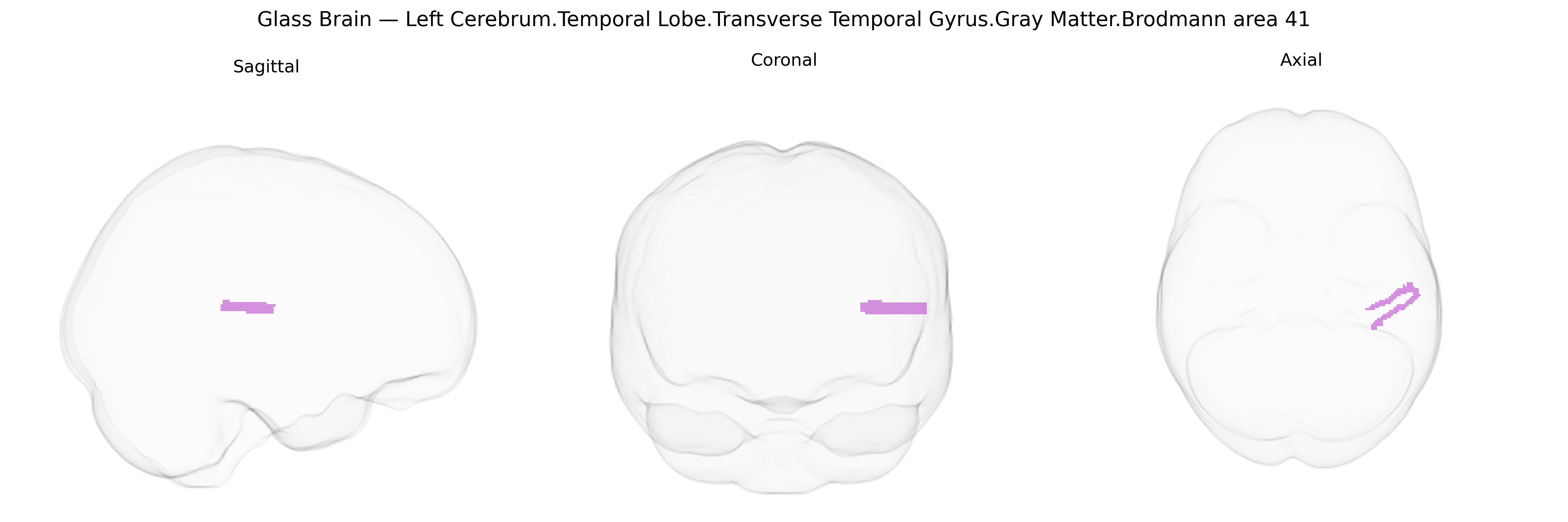 Triplanar Ghost Brain