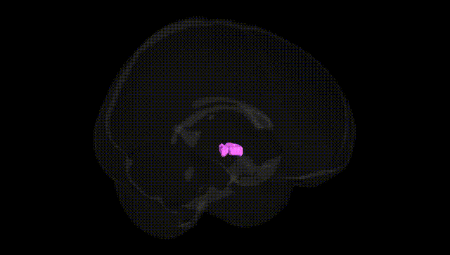 Full Brain Black
