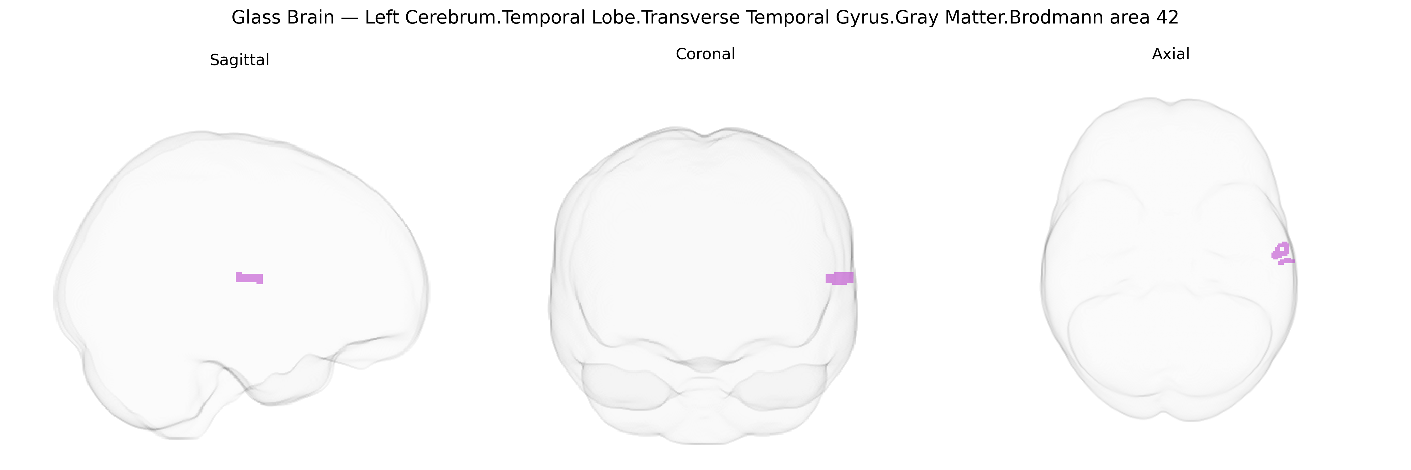 Triplanar Ghost Brain