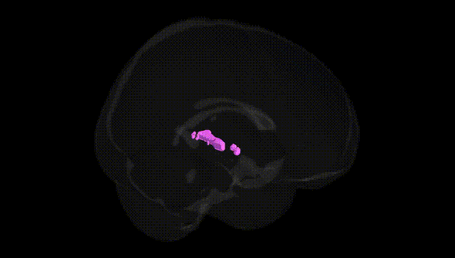 Full Brain Black