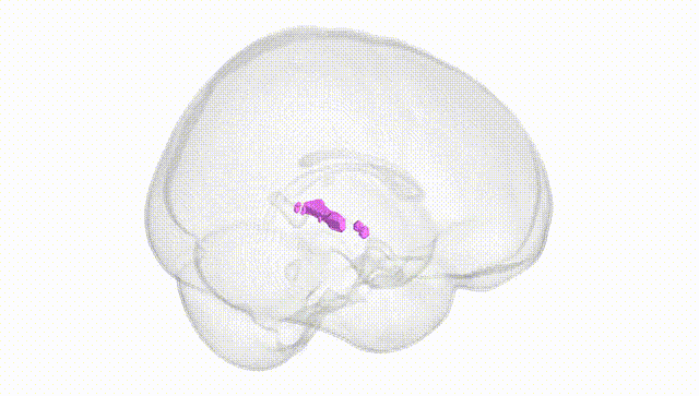 Full Brain White