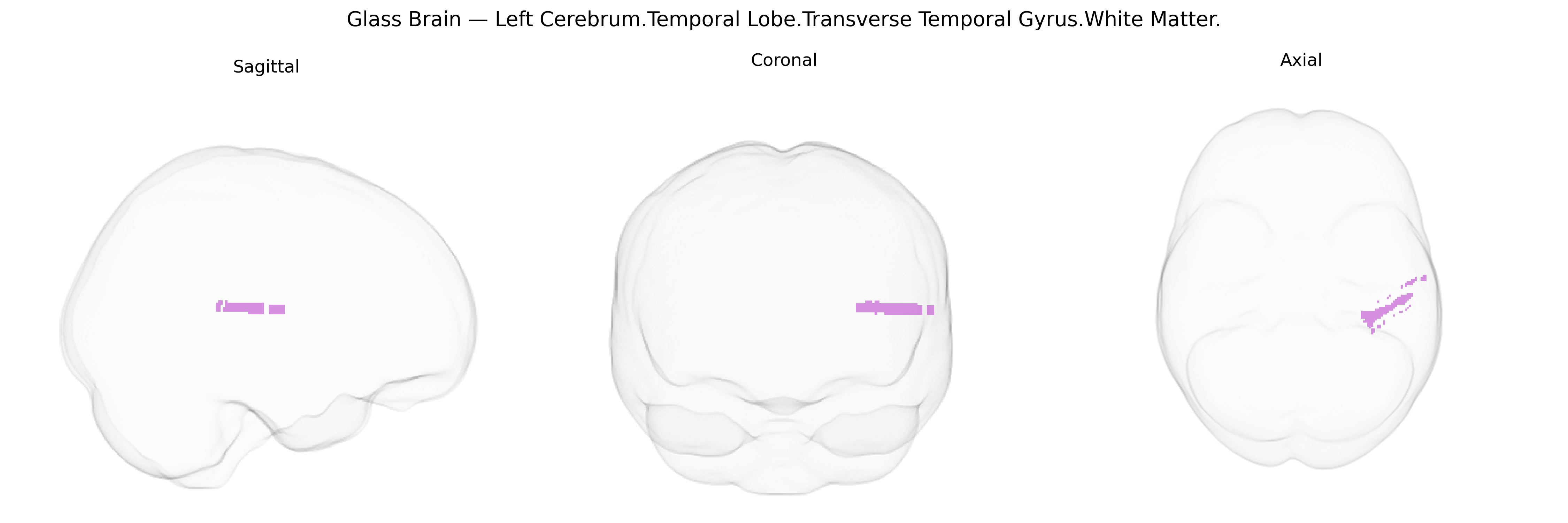 Triplanar Ghost Brain