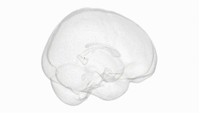 Full Brain White