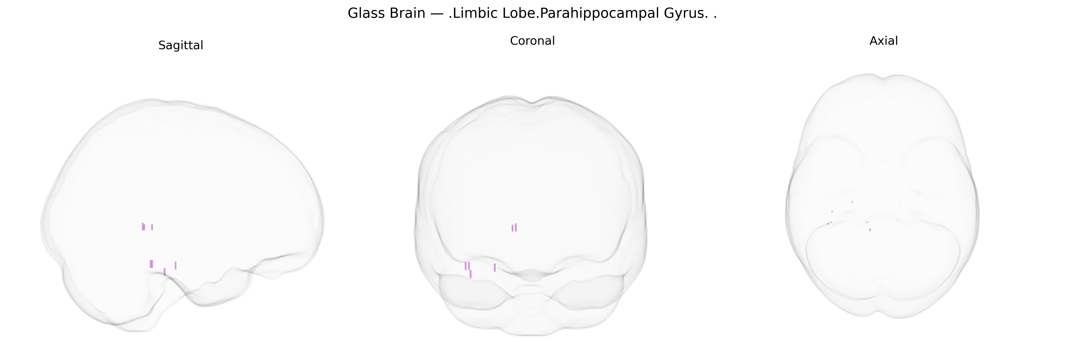 Triplanar Ghost Brain