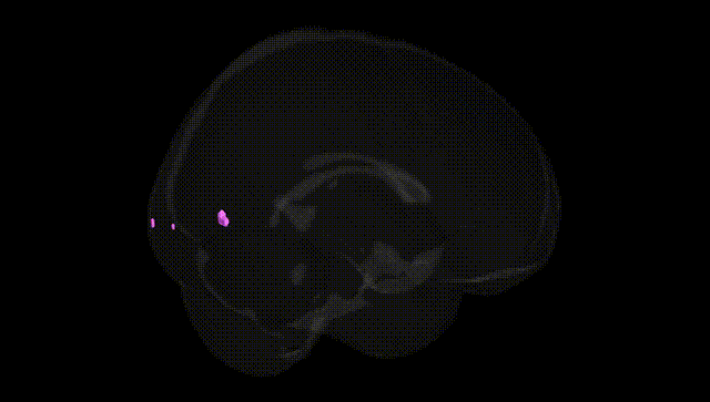 Full Brain Black