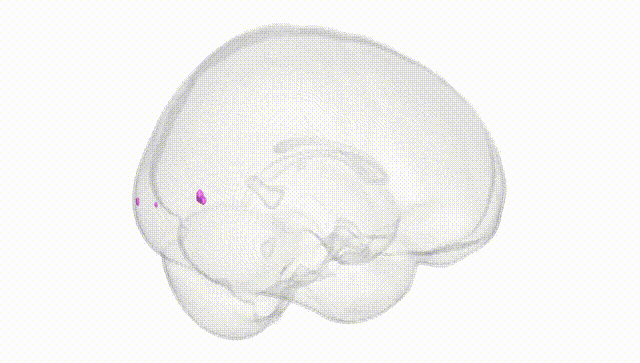 Full Brain White