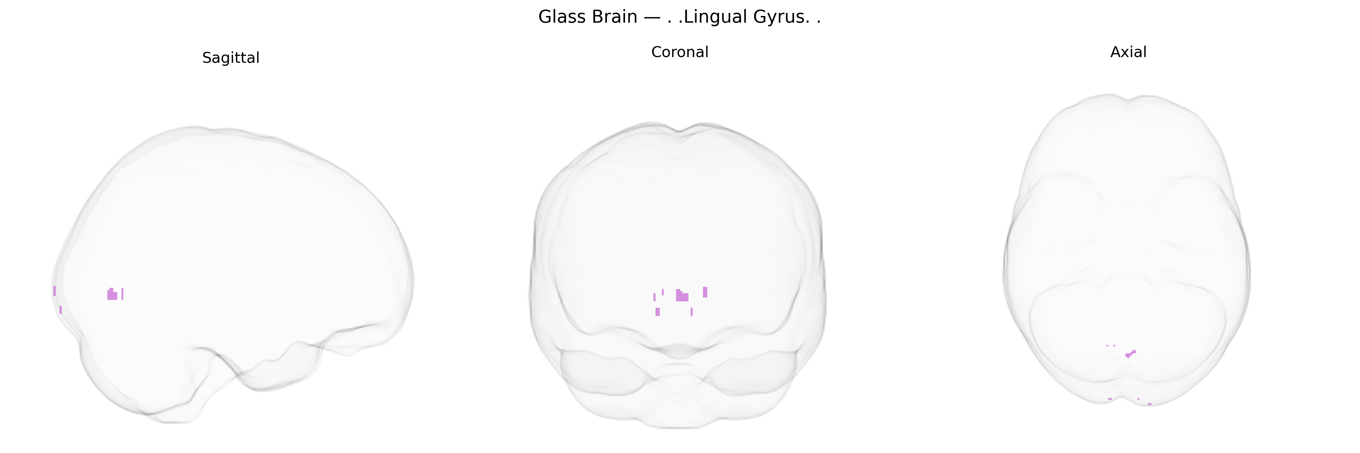 Triplanar Ghost Brain