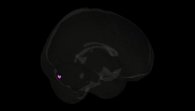 Full Brain Black