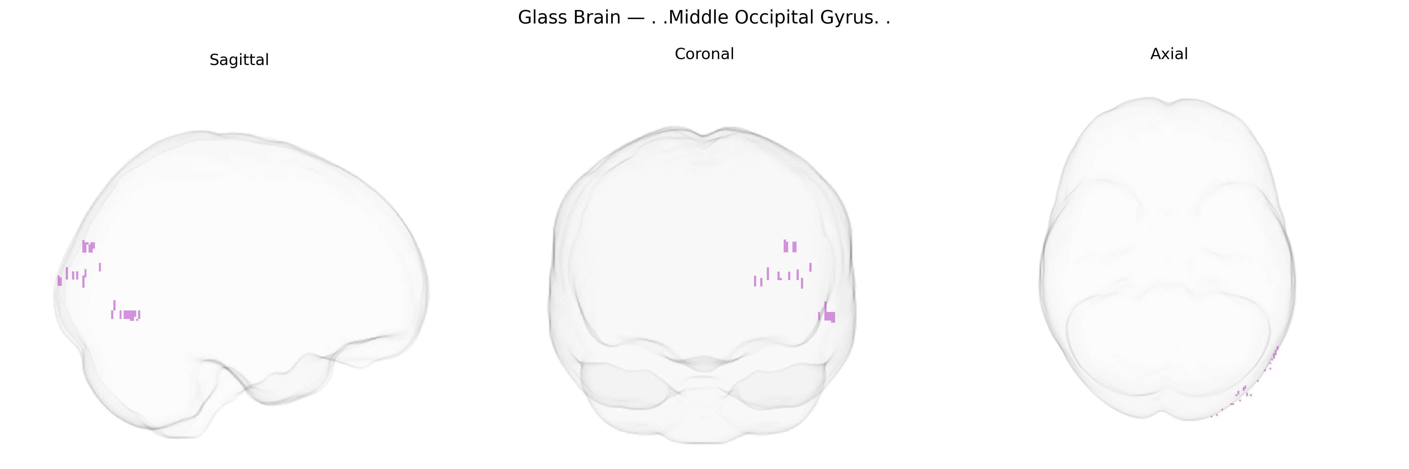 Triplanar Ghost Brain