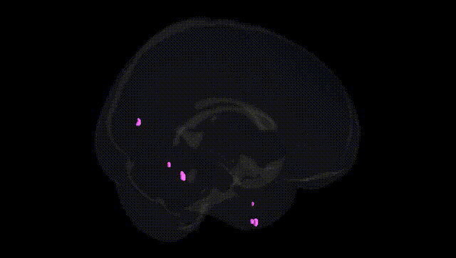 Full Brain Black