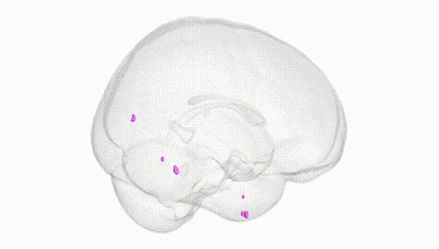 Full Brain White
