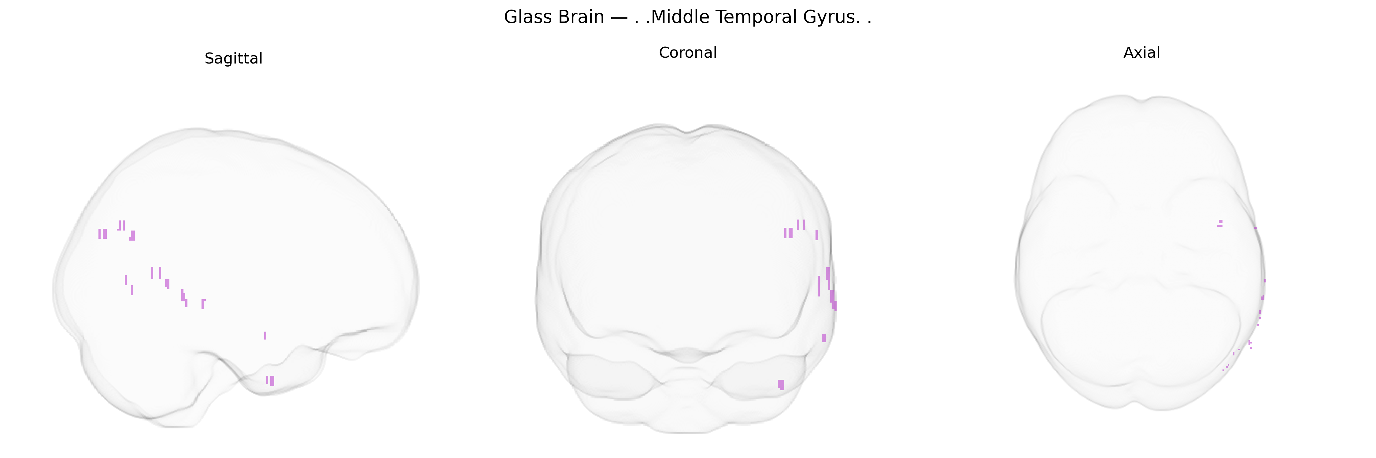 Triplanar Ghost Brain