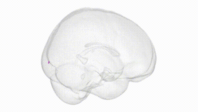 Full Brain White