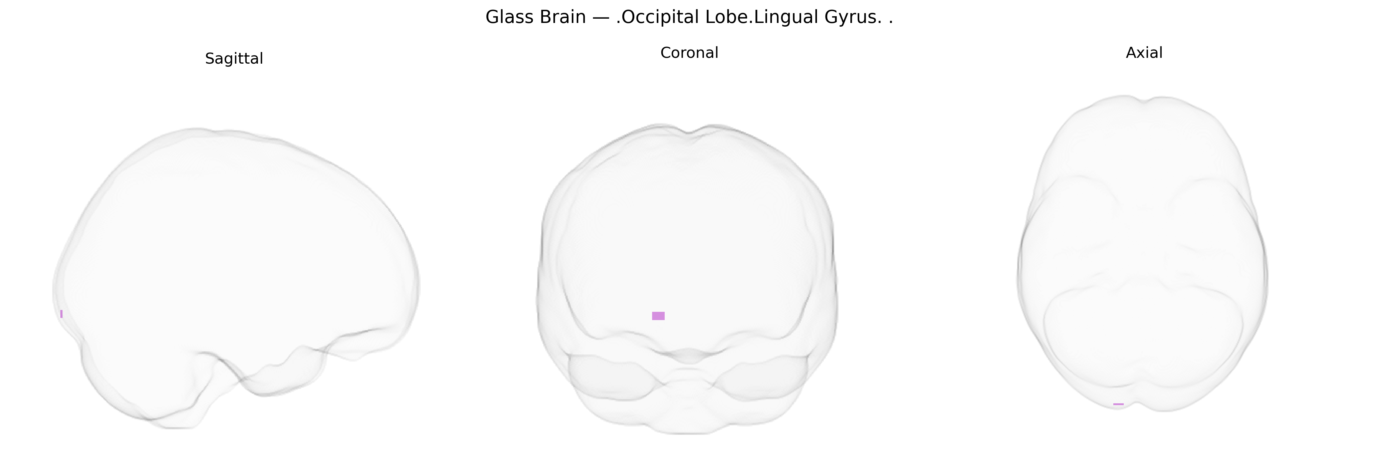 Triplanar Ghost Brain