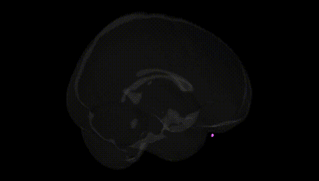 Full Brain Black
