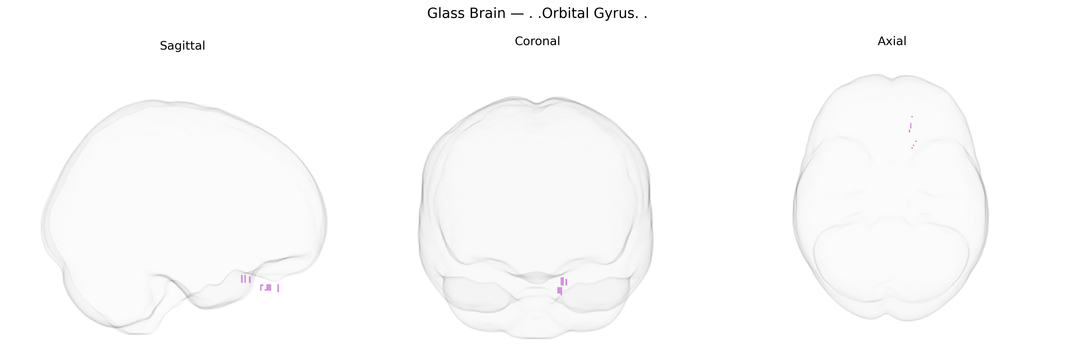 Triplanar Ghost Brain