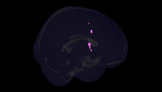 Full Brain Black