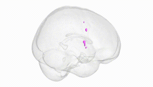 Full Brain White