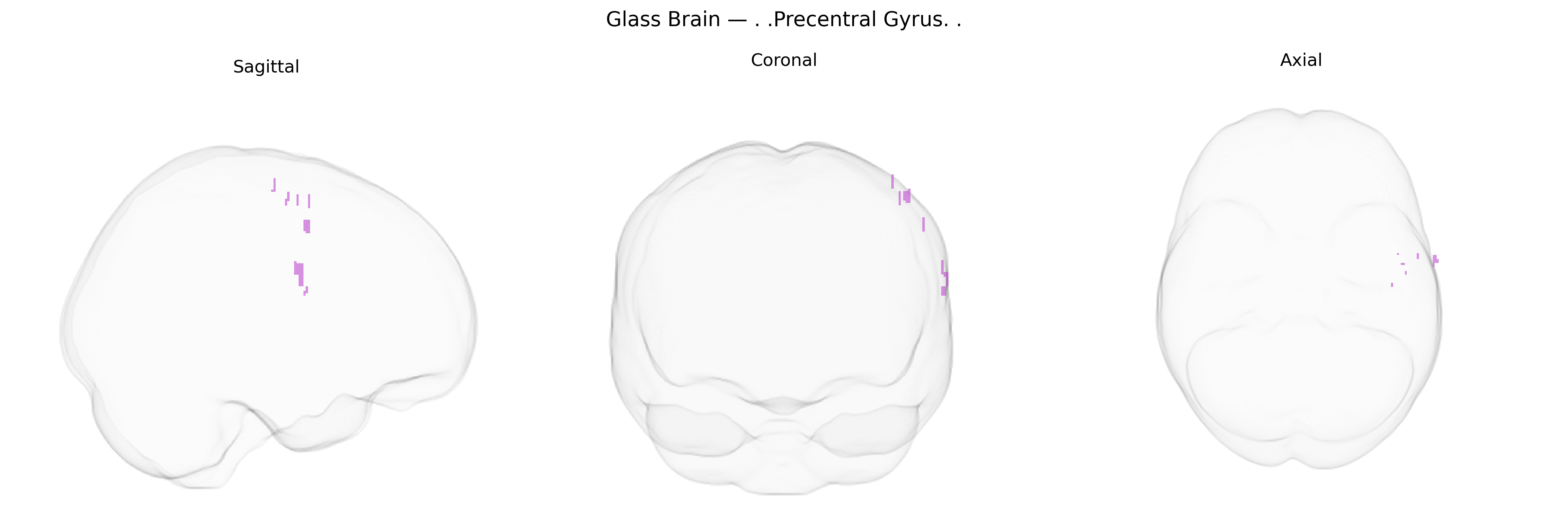 Triplanar Ghost Brain