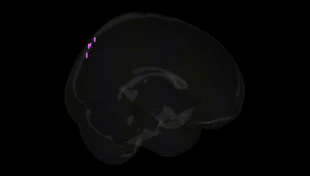 Full Brain Black