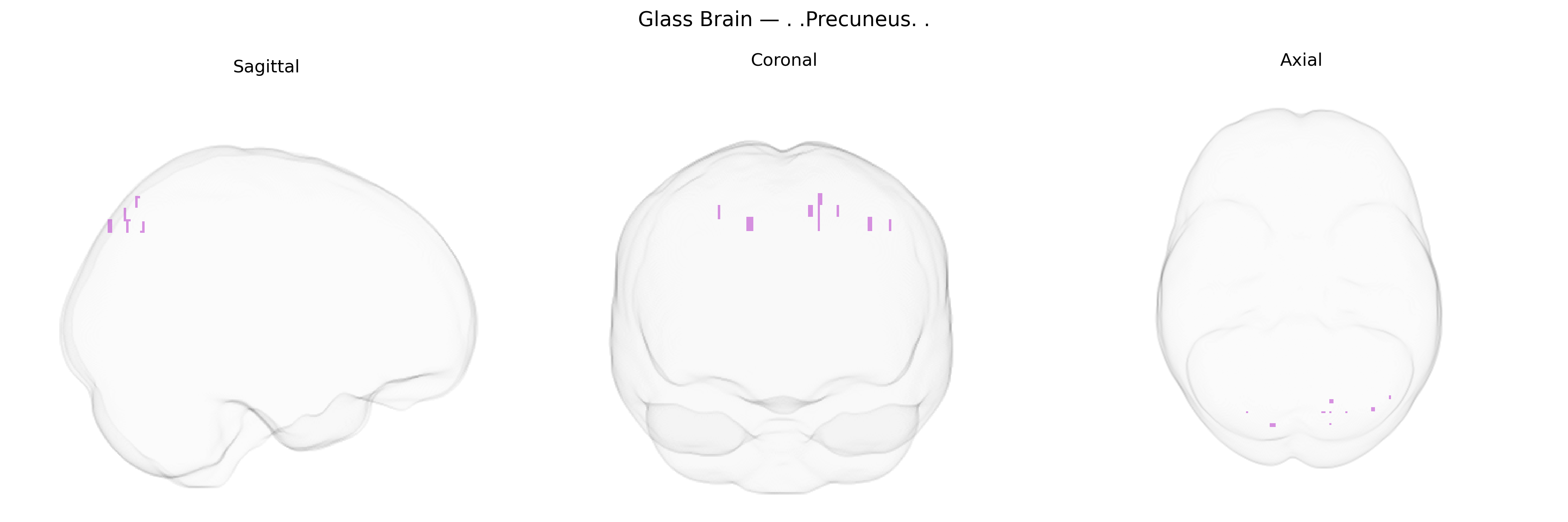 Triplanar Ghost Brain