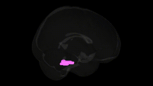 Full Brain Black
