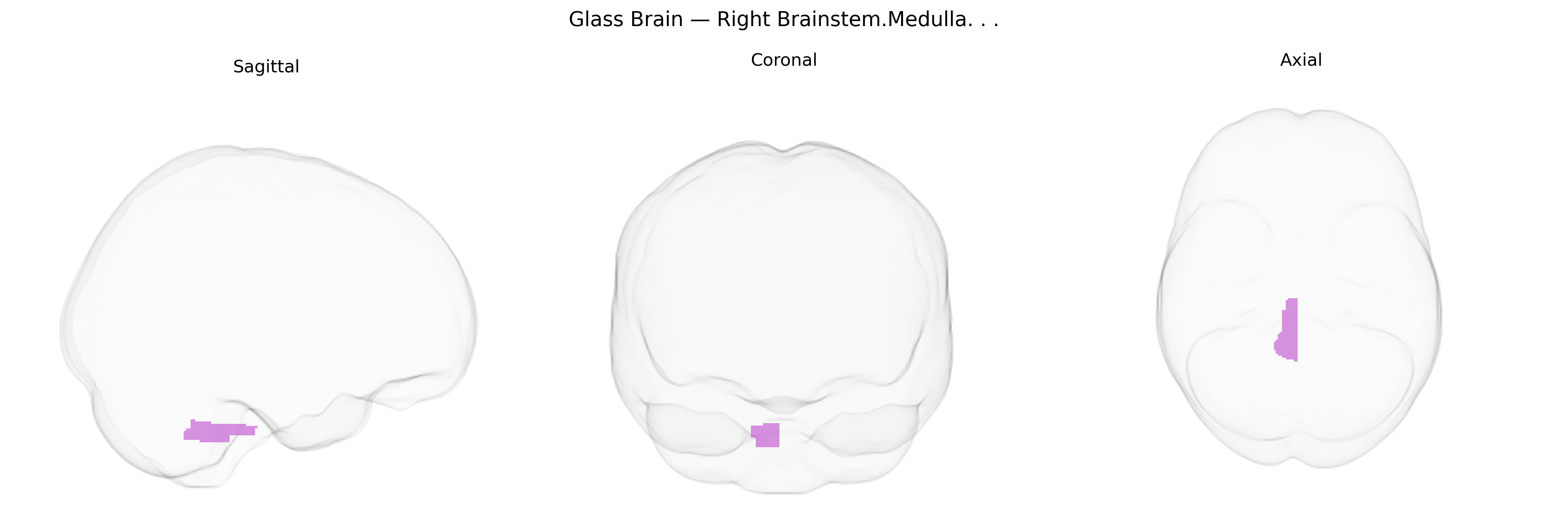 Triplanar Ghost Brain